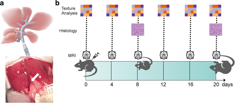 Radiomics of liver MRI predict metastases in mice