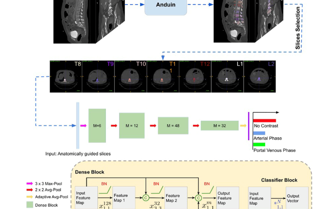 Artificial neural network detects contrast phase in MDCT