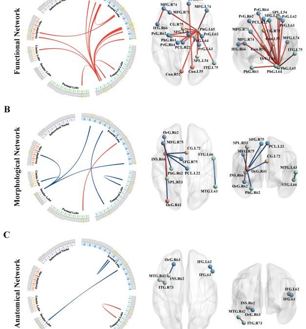 Machine learning based on the multimodal connectome can predict the preclinical stage of Alzheimer’s disease: a preliminary study