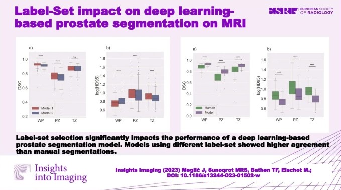 Label-set impact on deep learning-based prostate segmentation on MRI