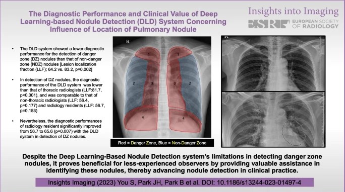 The diagnostic performance and clinical value of deep learning-based nodule detection system