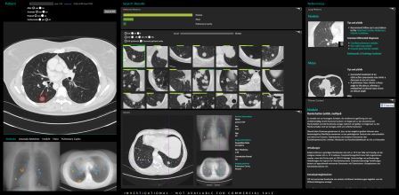 Using AI to ease the burden of the medical image data search
